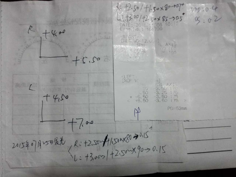 小露凡在治疗前的验光结果