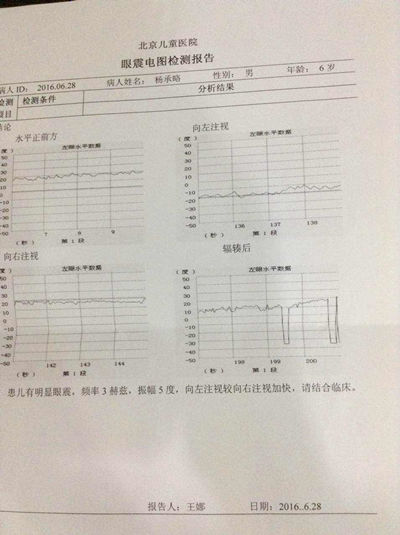 治疗后眼震电图检查结果