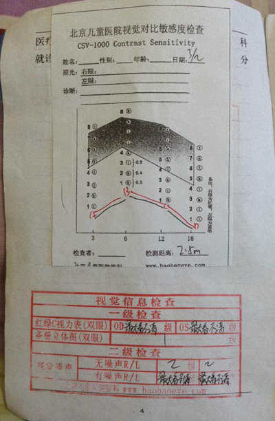 润宝治疗前视功能检查