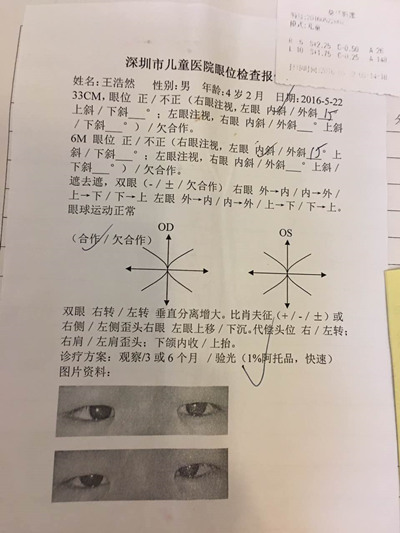 浩然的斜视检查报告